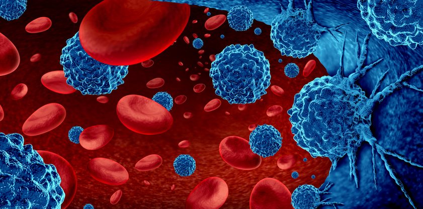 Le linee guida HiHASC: un nuovo strumento per la diagnosi dell’HLH